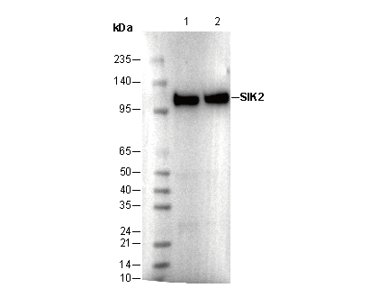 SIK2 Antibody