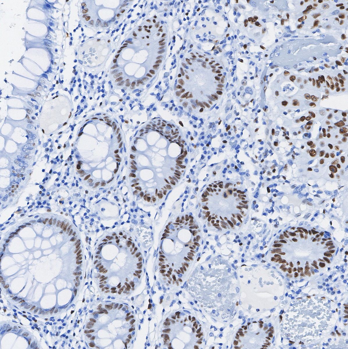 TEAD1 Antibody