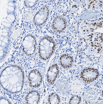 TEAD1 Antibody