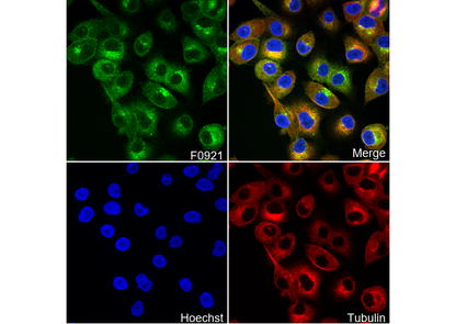 β2-microglobulin Antibody