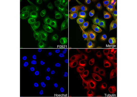 β2-microglobulin Antibody