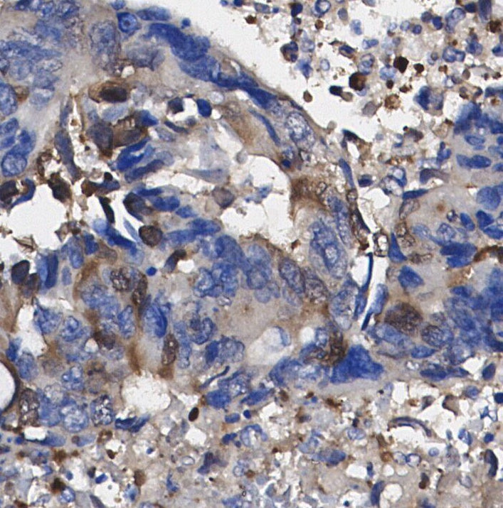 β2-microglobulin Antibody