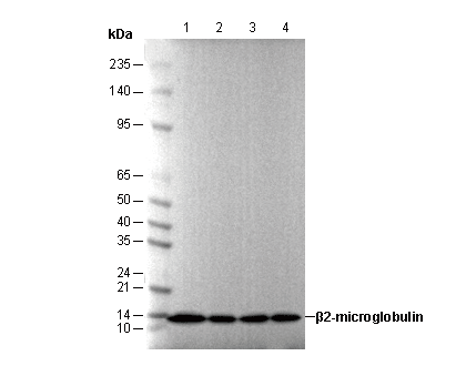 β2-microglobulin Antibody