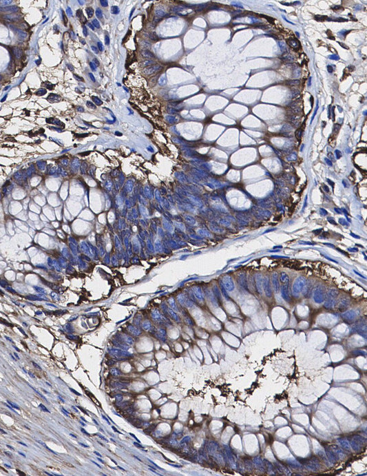 Clathrin Heavy Chain Antibody
