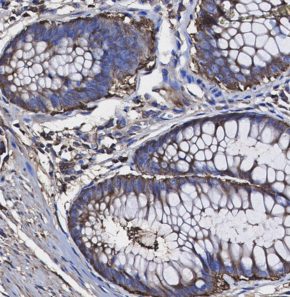 SERCA2 ATPase Antibody