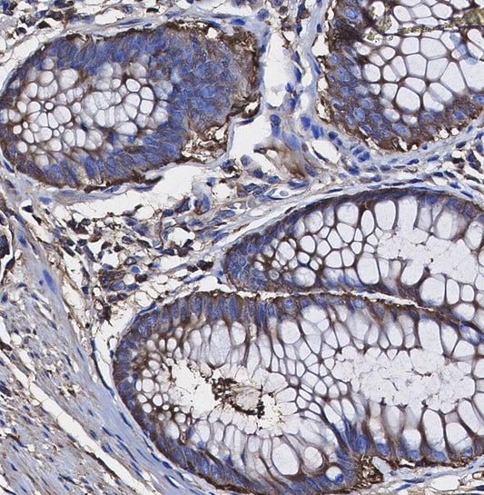 SERCA2 ATPase Antibody