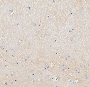 Tau Antibody