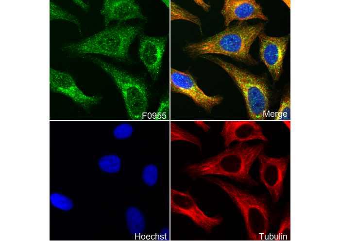 Phospho-SQSTM1/p62 (Ser403) Antibody