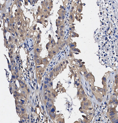 EB1 Antibody