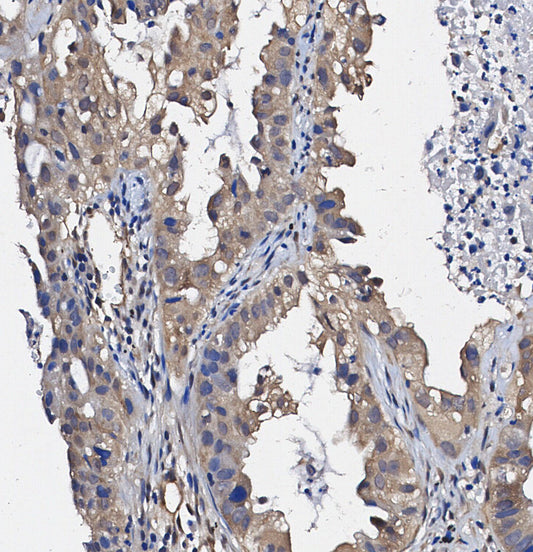 EB1 Antibody
