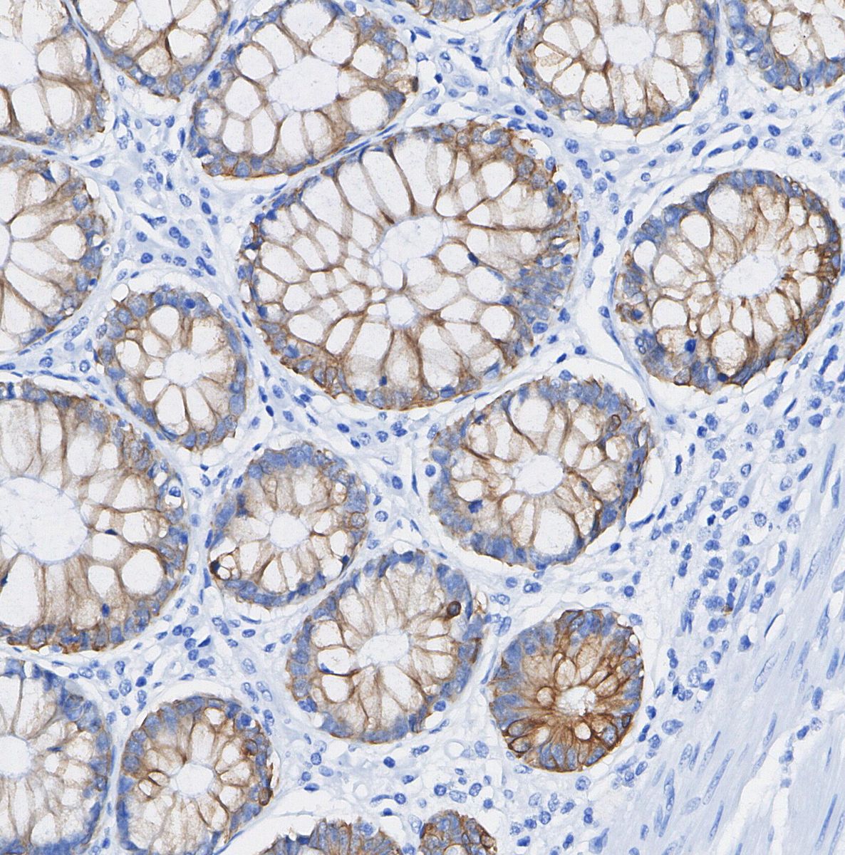 CD63 Antibody
