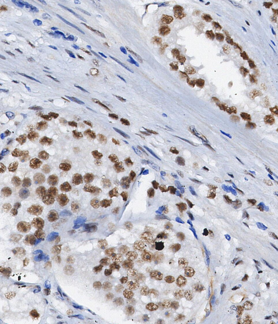 CRTC3 Antibody
