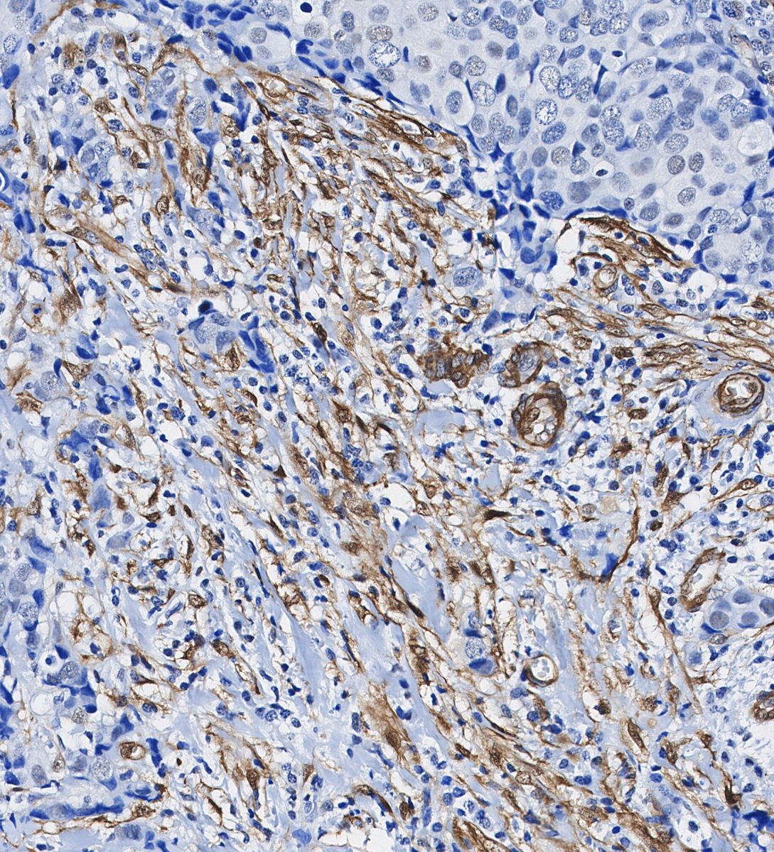 Calponin 1 Antibody