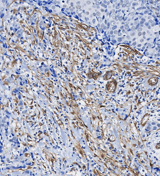 Calponin 1 Antibody