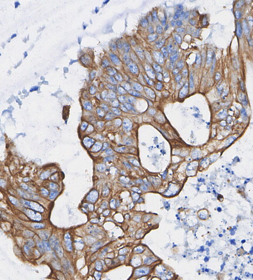 Claudin 3 Antibody