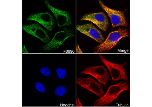 Cytokeratin 19 Antibody