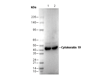 Cytokeratin 19 Antibody
