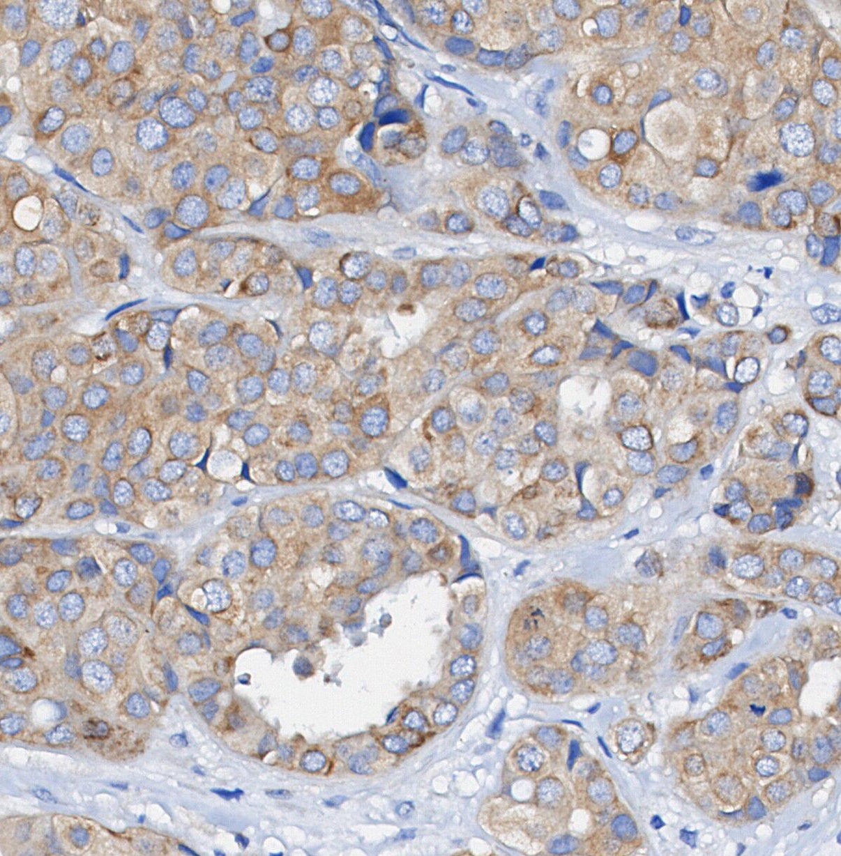 IKKα Antibody