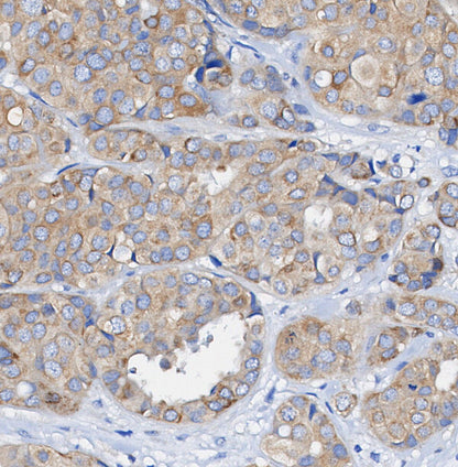 IKKα Antibody