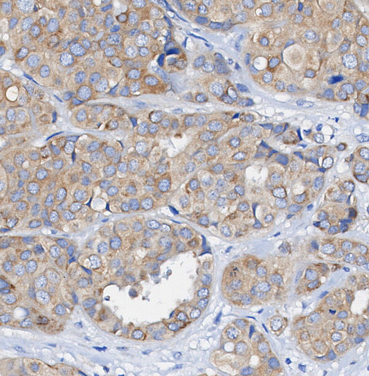 IKKα Antibody
