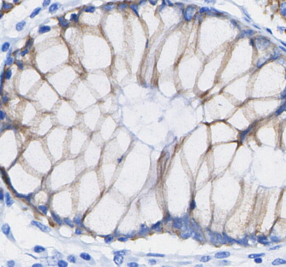 Integrin αV Antibody
