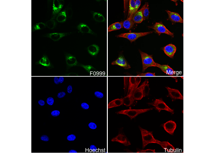 Lipocalin-2 / NGAL Antibody