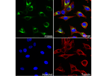 Lipocalin-2 / NGAL Antibody