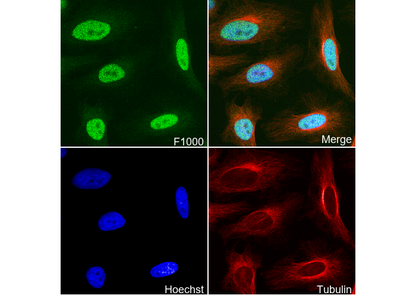 METTL3 Antibody