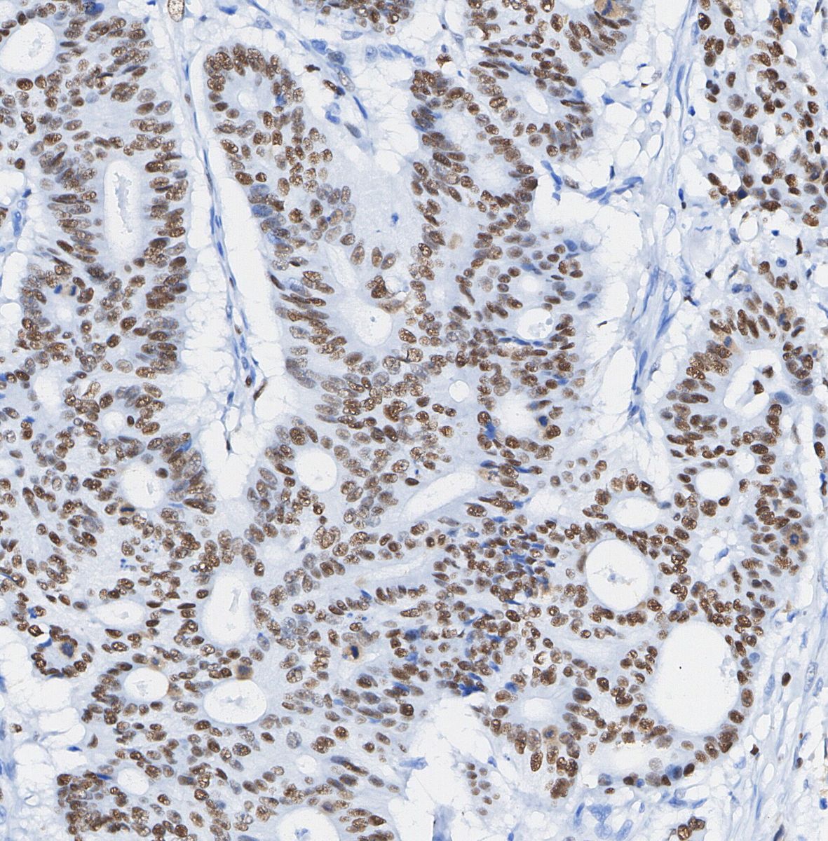 METTL3 Antibody