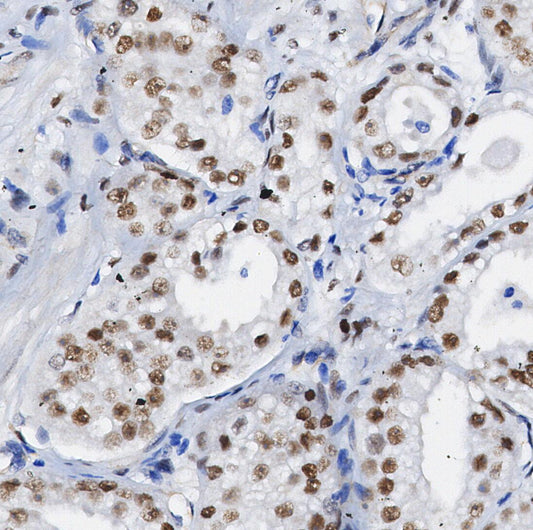 MLH1 Antibody