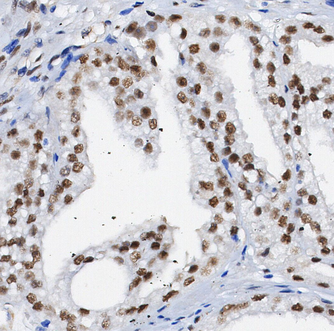 OS9 Antibody