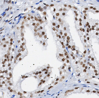 OS9 Antibody
