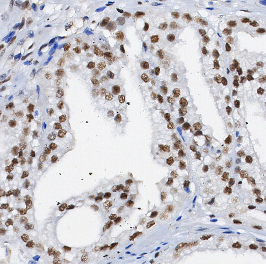 OS9 Antibody