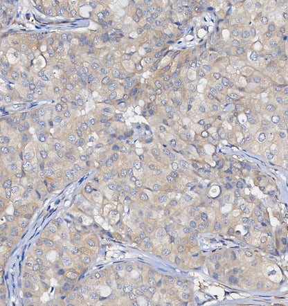 PCK2 Antibody