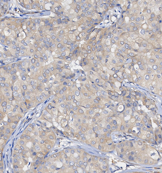 PCK2 Antibody