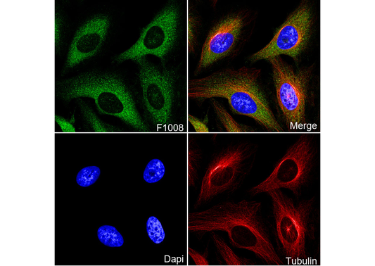 PKCα Antibody