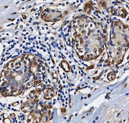 PRMT5 Antibody