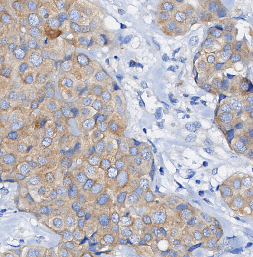 RENT1/hUPF1 Antibody
