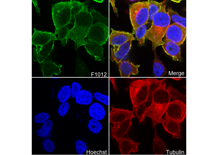 Radixin Antibody