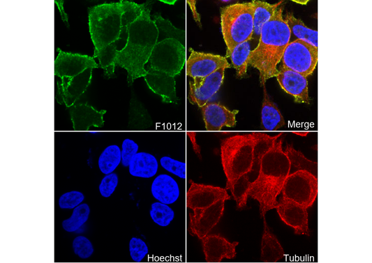 Radixin Antibody