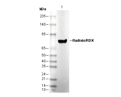 Radixin Antibody