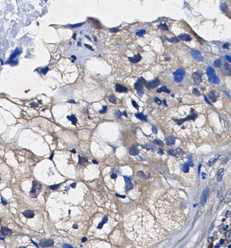 SOS1 Antibody