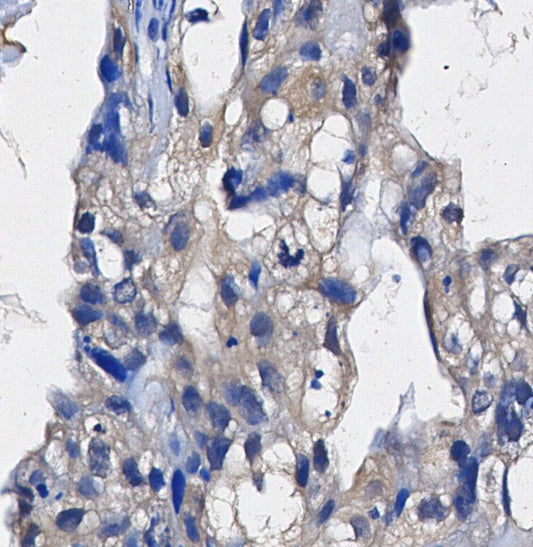 TGFBI Antibody