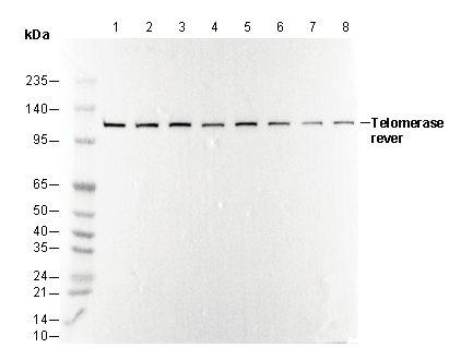 Telomerase reverse Antibody
