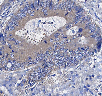 VCP Antibody