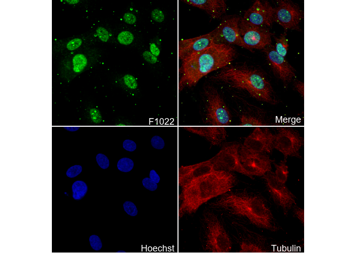 5 Lipoxygenase/5-LO Antibody