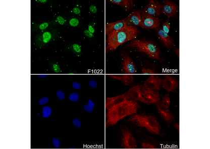 5 Lipoxygenase/5-LO Antibody