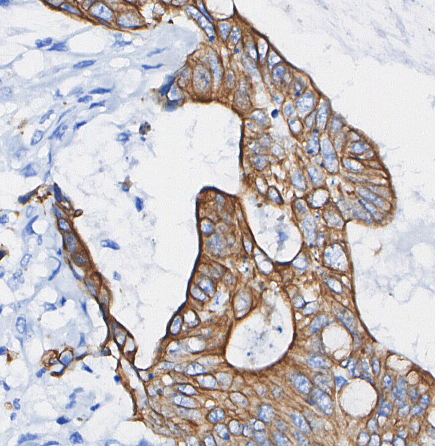 ALDH1A1 Antibody