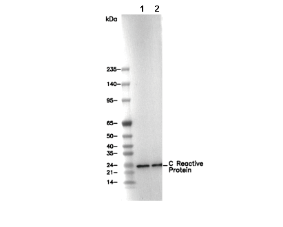 C Reactive Protein Antibody