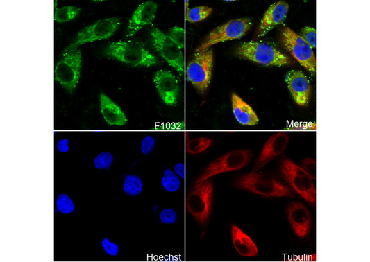 CaMKII Antibody